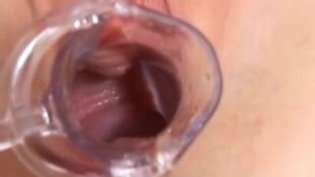 Sophie Gets her Pussy Explored with a Speculum